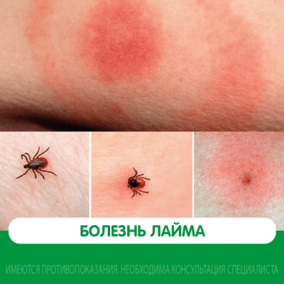 Главное изображение