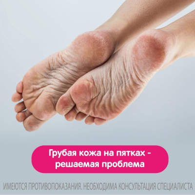Главное изображение