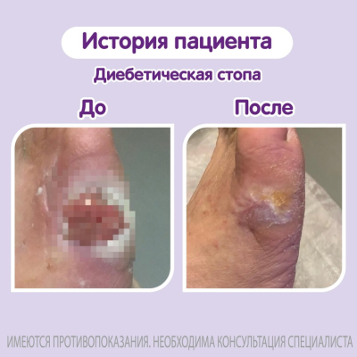 Главное изображение